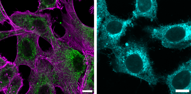 Project 12 - Exploring the anti-cancer activity and molecular targets of avenacins