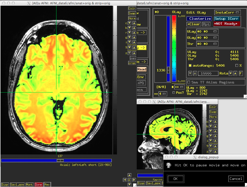 Screenshot of AFNI fMRI Analysis Tool