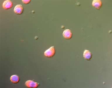 Microscopic image of AML vesicles