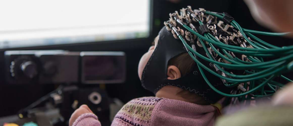 baby with wires on head