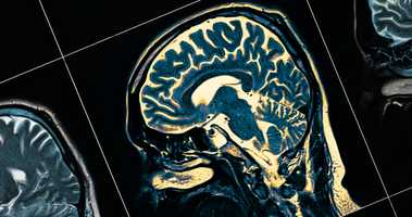 Brain scan image