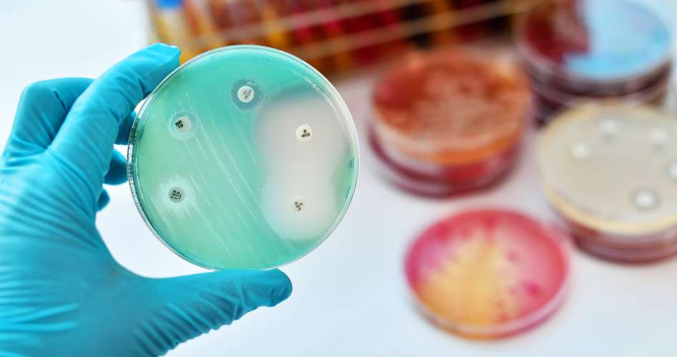 Antimicrobial Susceptibility Test 