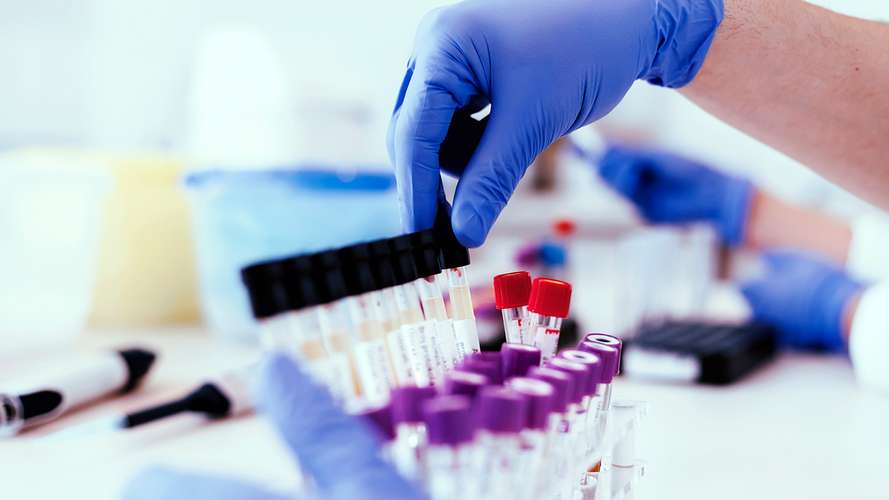 scientific test tubes