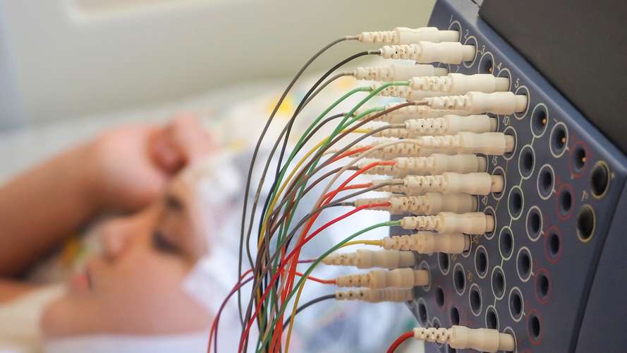 electrodes connected to medical equipment