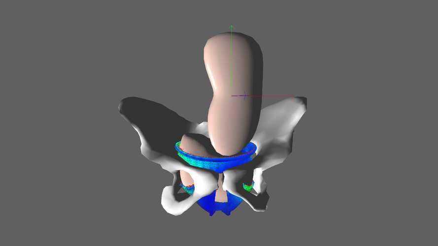 BirthView5