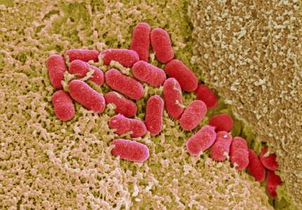 Scanning electron micrograph of EHEC adhering to human colonic epithelium