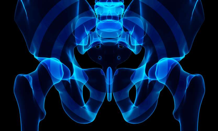 Illustrated X-Ray of Hips