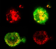 Mitophagy in vesicles released from cancer cells