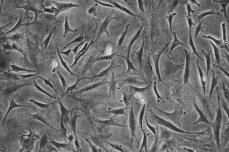 Black and white microscopic image of primary chondrocytes