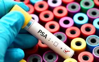 Prostate cancer test tube