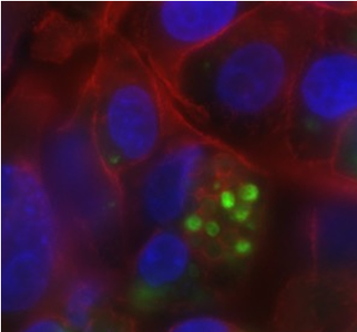 Gut bacteria on red and blue background