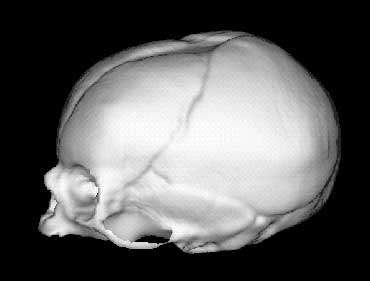 3 Lateral view of undeformed fetal skull.jpg