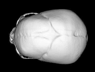5 Top view of undeformed fetal skull.jpg