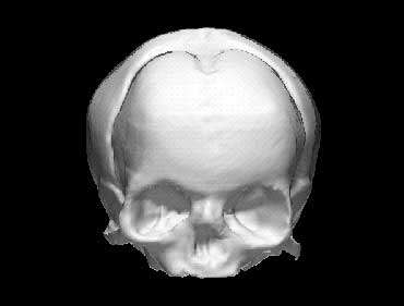 1 Front view of undeformed fetal skull.jpg