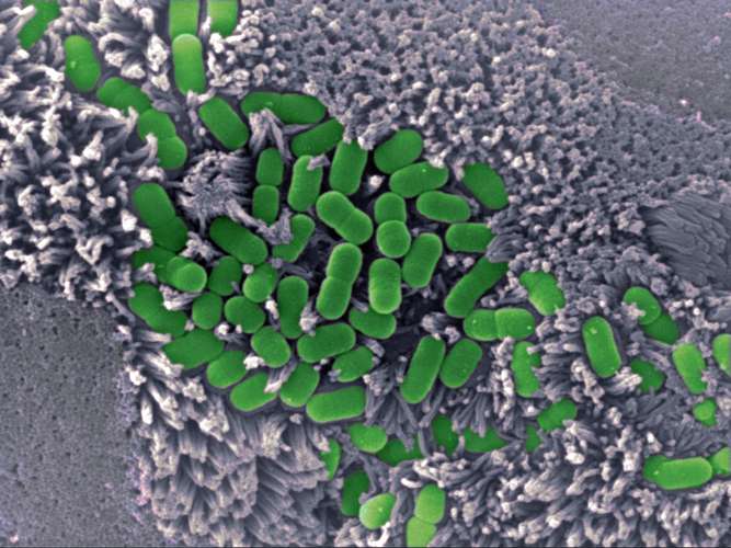 green microbes on grey background