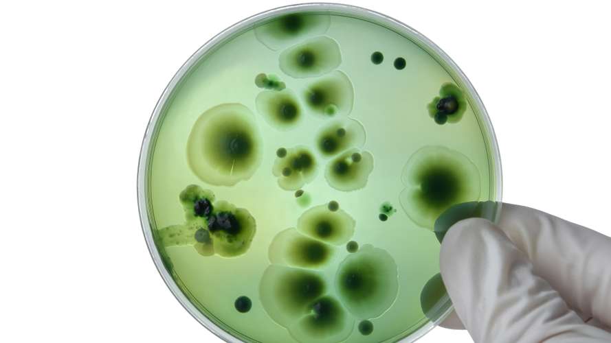 Science petri dish and glove