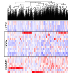 •	Hierarchical clustering shows gene expression across a range of bone and cancer tissues