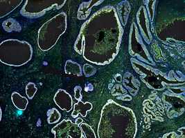 Multiplex immuno fluorescence image of a prostate tissue section