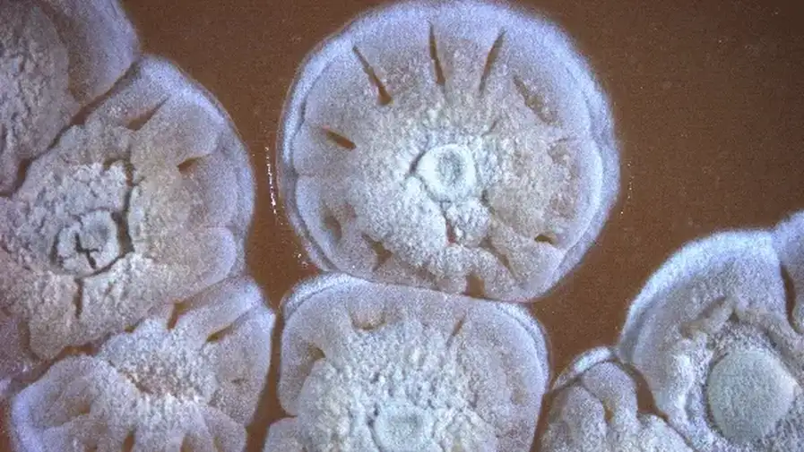 Streptomyces-bacteria-aspect-ratio-16-9png