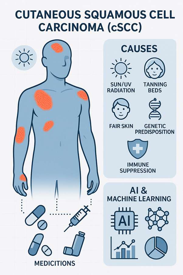Illustration of cutaneous squamous cell carcinoma showing affected areas, causes, and treatment options like medications and AI applications.