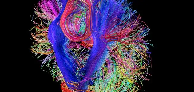 A colourful visualisation of the brain's white matter tracts from a DTI scan, showcasing neuroscience and medical imaging research in Norwich.