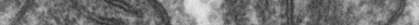 Transmission electron microscope image of a thin section cut through an area of mammalian lung tissue. The high magnification image shows two mitochondria.
