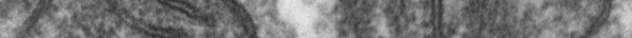 Transmission electron microscope image of a thin section cut through an area of mammalian lung tissue. The high magnification image shows two mitochondria.