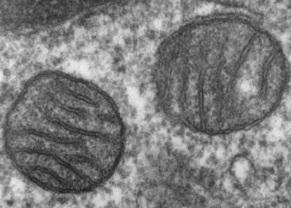 Transmission electron microscope image of a thin section cut through an area of mammalian lung tissue. The high magnification image shows two mitochondria.