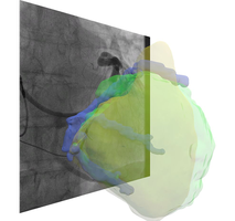 image analysis heart cta