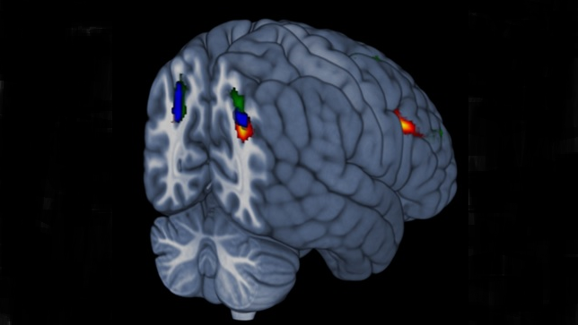 3D rendered MRI brain image with highlighted areas of brain activation during a research MRI scan