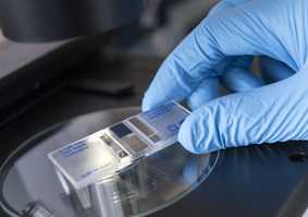 blue medical glove holding science research slide