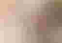 Loading image...