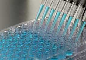 Medical diagnosis tests