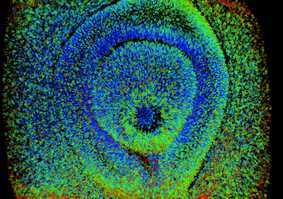 Reconstructing signalling activities in the developing eye