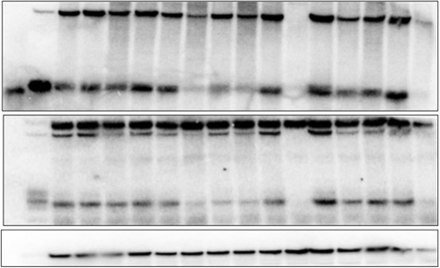 biology gel