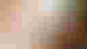 Loading image...