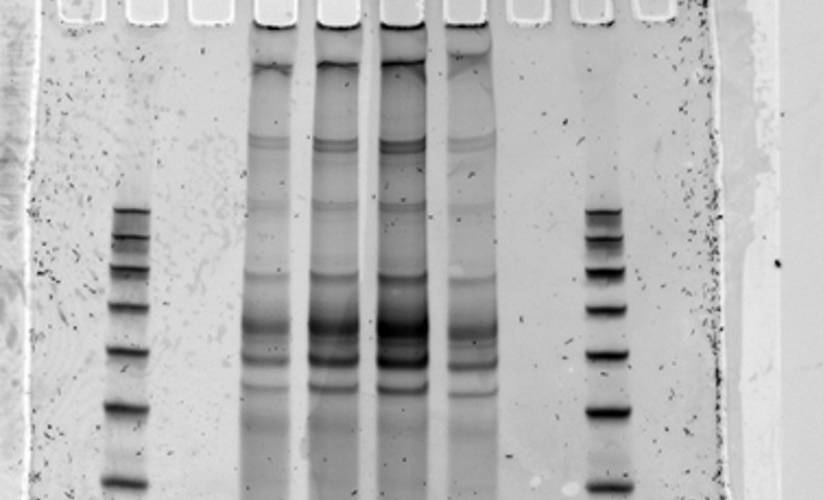 PAGE gel for small RNA libraries