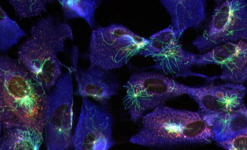 Astral microtubules during mitosis