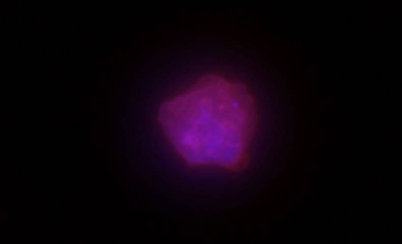 Circulating tumour cells