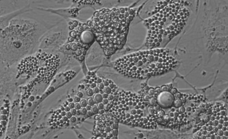 fat cells