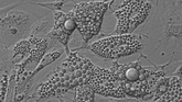 fat cells