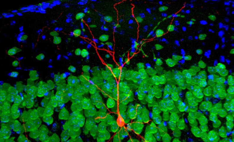 Brain Neuron