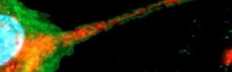 Microscopic image of Mitochondrial transfer in HSC