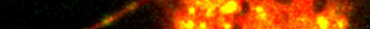 Microscopic image of mitochondrial transfer