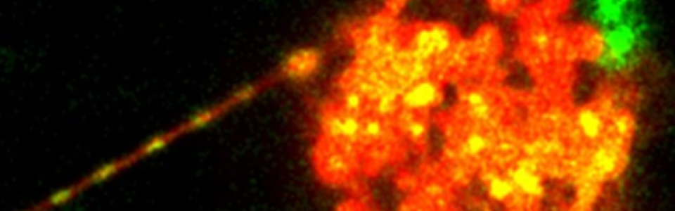 Microscopic image of mitochondrial transfer