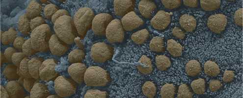 Microscopic bacteria