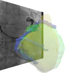 Reducing X-ray exposure