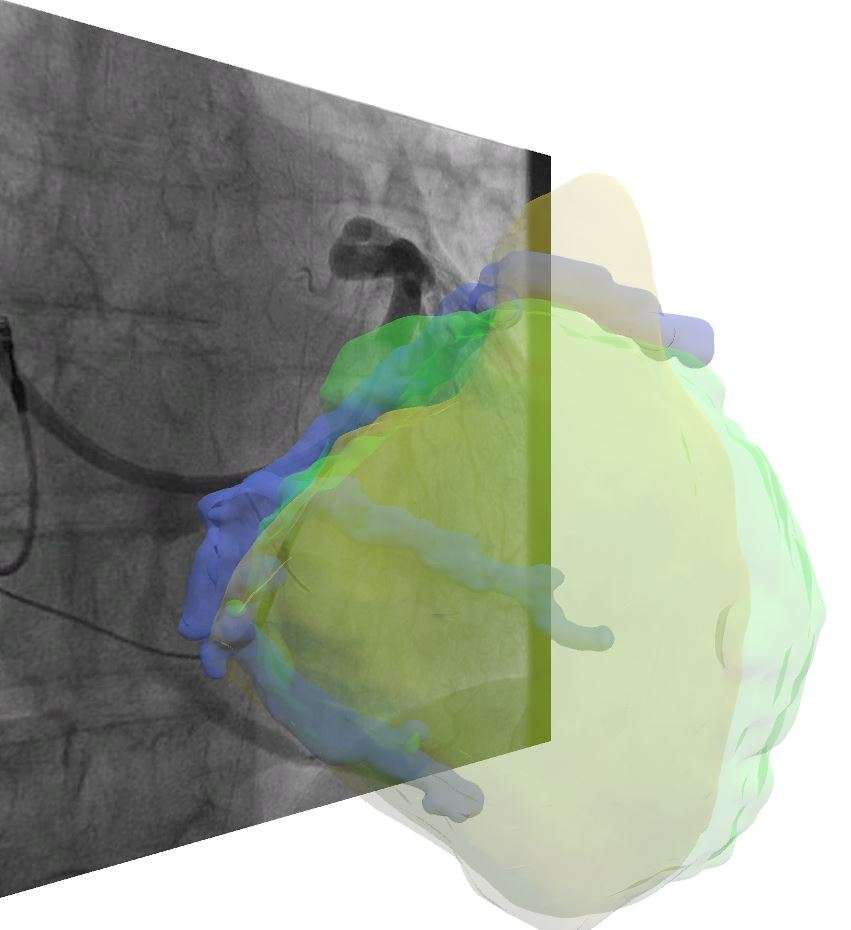 Reducing X-ray exposure