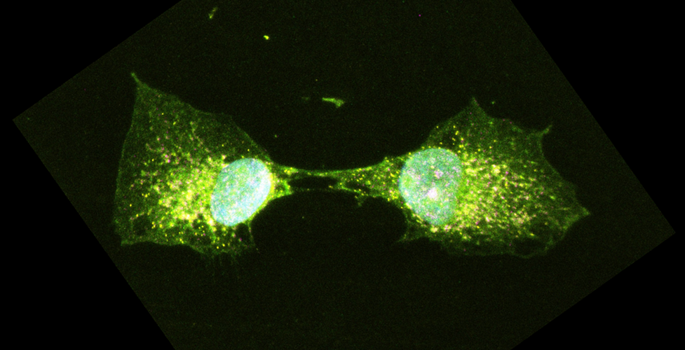 Microscopic image of two cells splitting