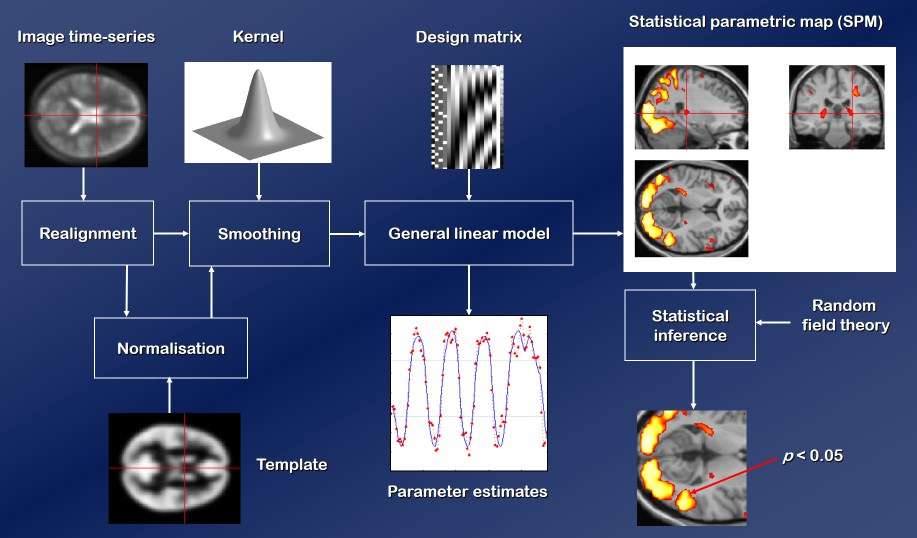 A visual description of the process of SPM analysis in fMRI